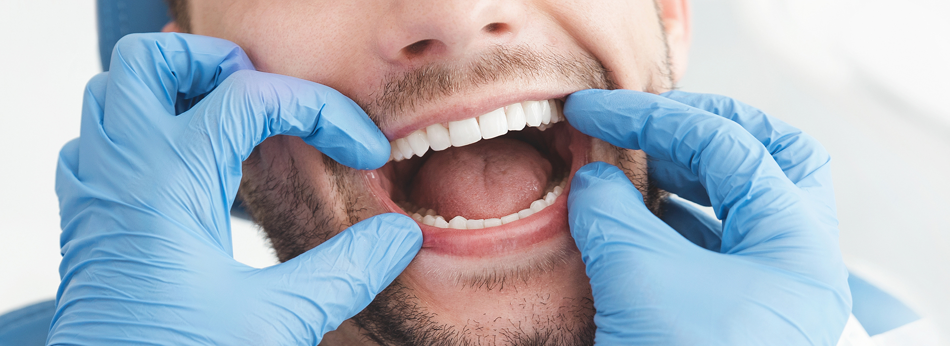 The image shows a person with an open mouth sitting in front of a dental chair, wearing blue gloves and a white surgical mask, performing a dental procedure on a patient.