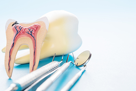 The image displays two side-by-side photographs featuring toothbrushes with anatomical illustrations of a tooth s root system, one set against a blue background and the other against a yellow background, placed on a dental tray with dental tools in the foreground.