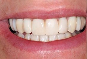 The image features a person with a bright smile showing straight white teeth, looking directly at the camera.