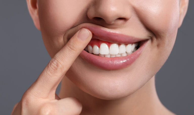 Gum Disease Treatment