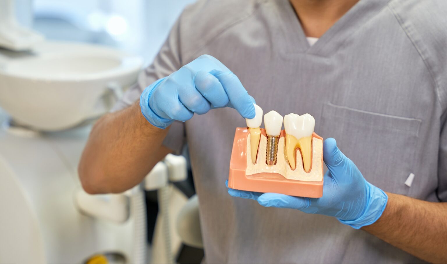 Types of Dental Implants Parker CO Dentist Plaza Dental Parker